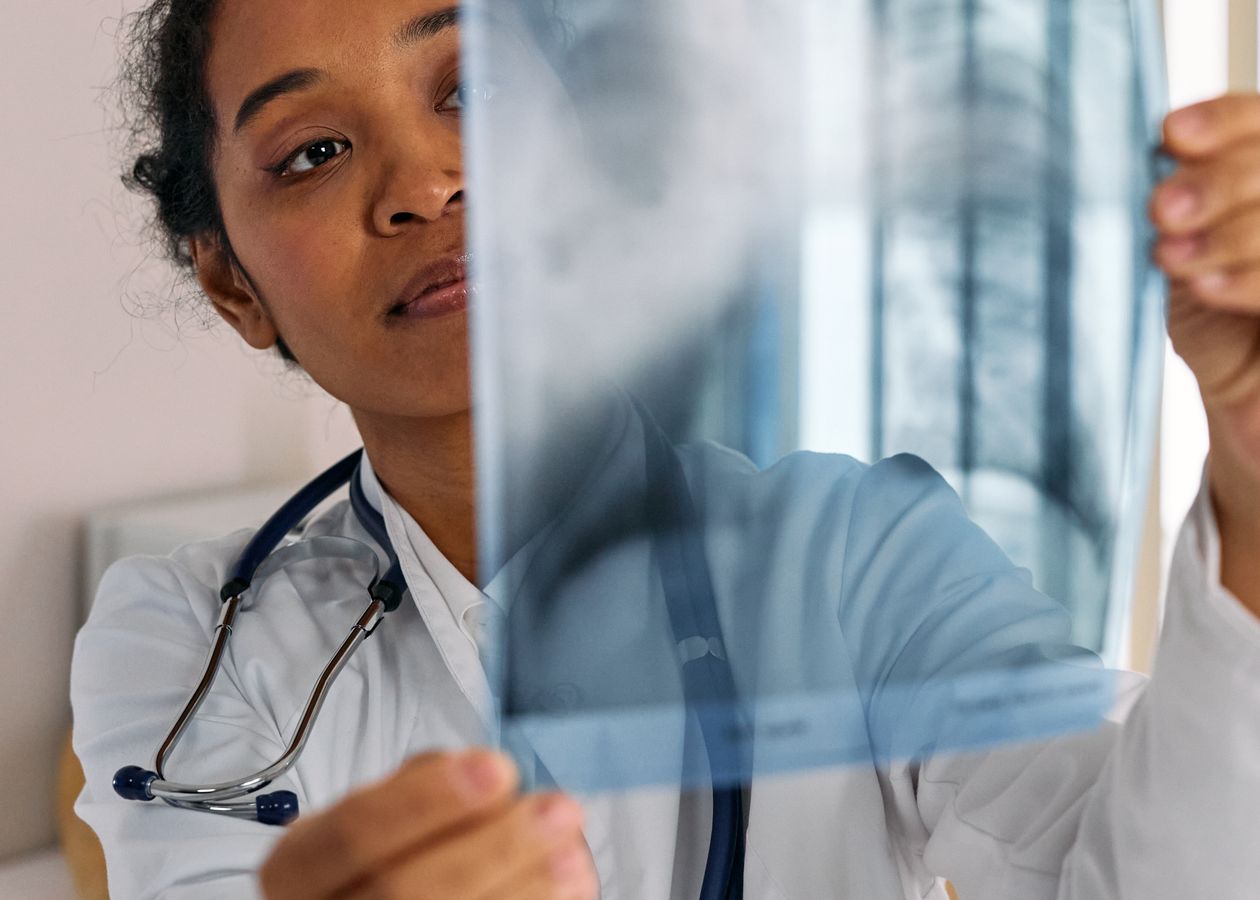 Doctor reviewing a diagnostic X-ray film