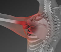 Rotator Cuff Shoulder Injuries