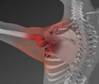 Rotator Cuff Tear  Seacoast Orthopedics & Sports Medicine