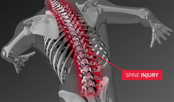 Spinal Injuries & Spine Conditions - Sterling Medical Group