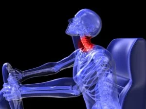 whiplash from car crash