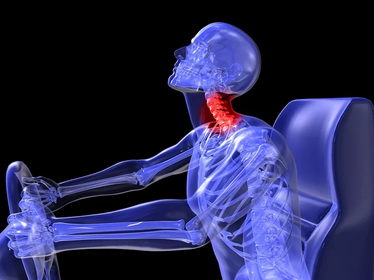 whiplash from car crash